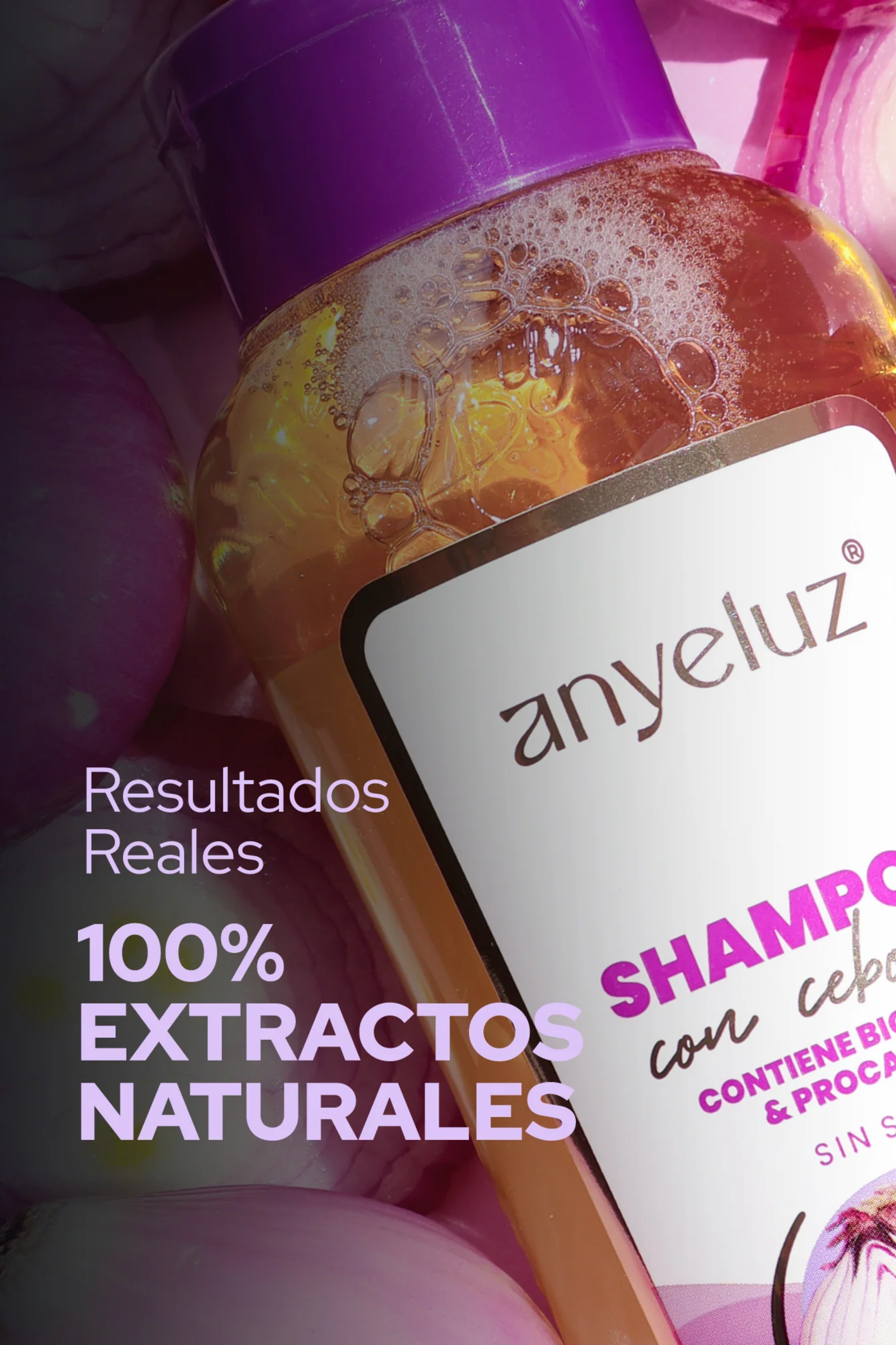 SHAMPOO CEBOLLA ANYELUZ